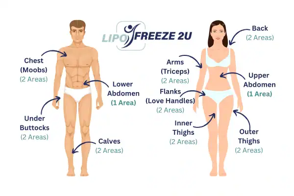 Areas you can have fat freezing treatment Merthyr Tydfil