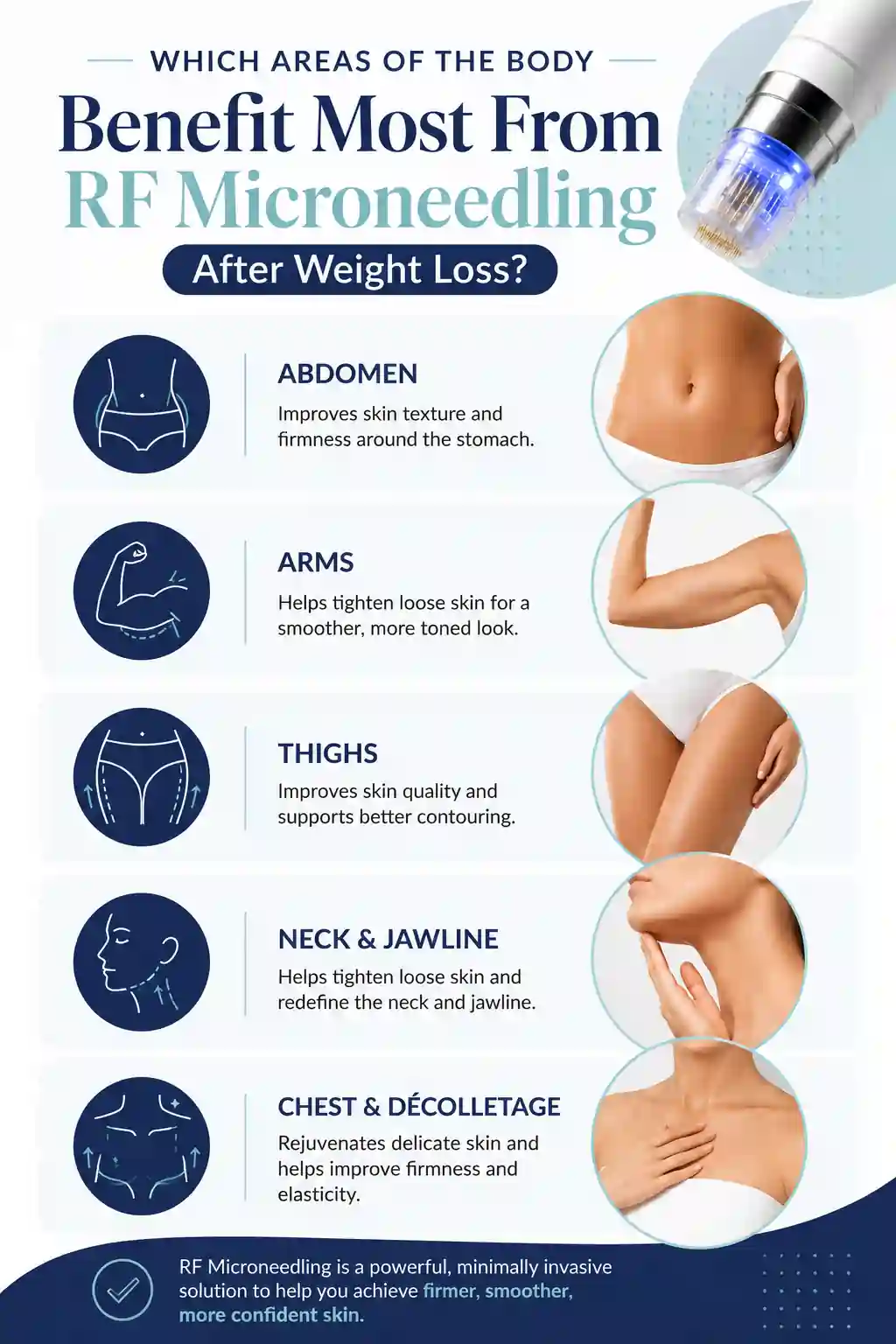 Which Areas of the Body Benefit Most From RF Microneedling After Weight Loss Merthyr Tydfil